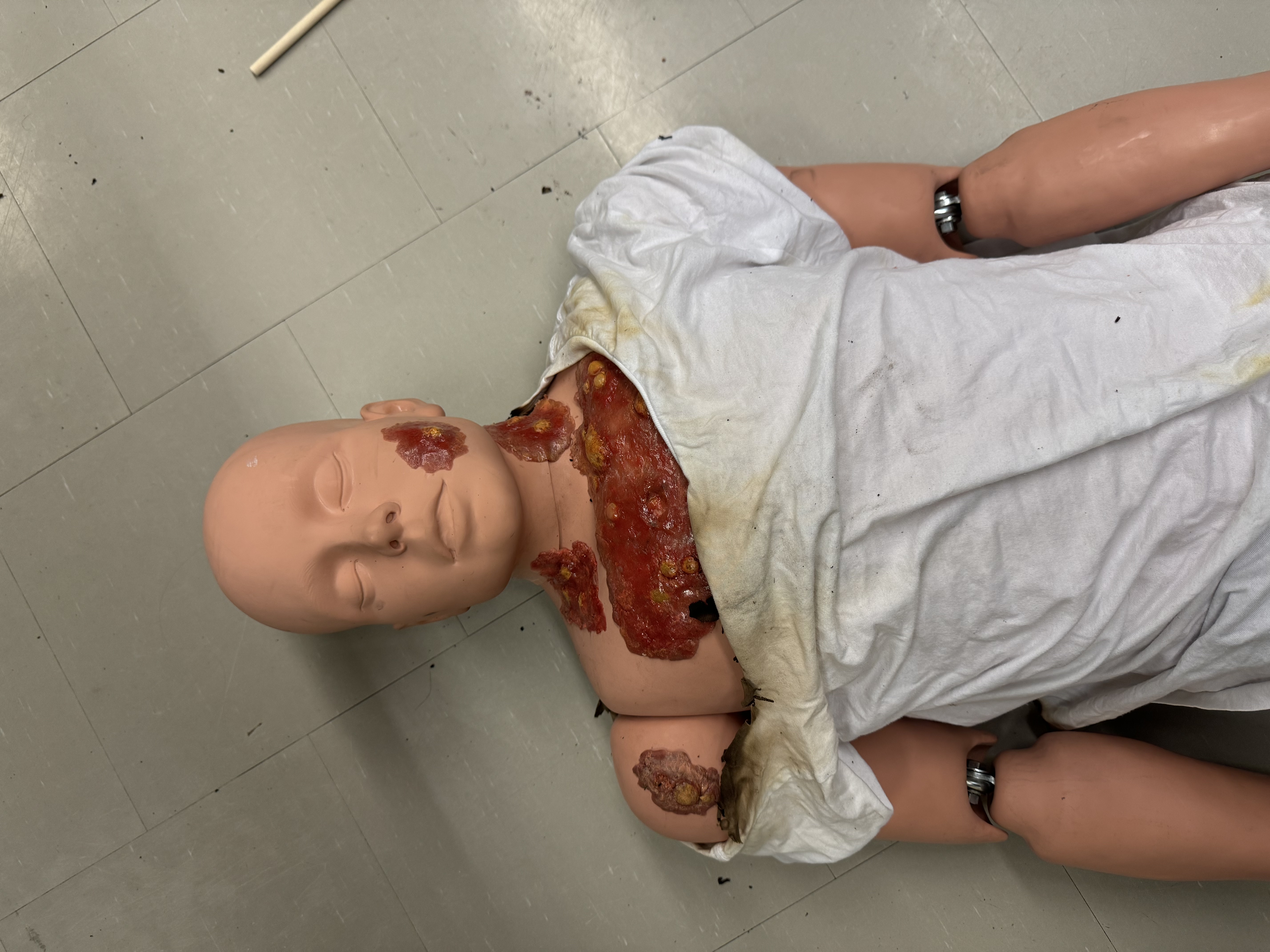 Fake Burn Victim Image